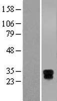 HLA DM (HLA-DMA) Human Over-expression Lysate