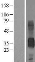 CD7 Human Over-expression Lysate