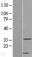 CAPZA2 Human Over-expression Lysate