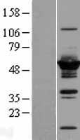 DYNC1LI2 Human Over-expression Lysate