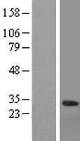 Granzyme A (GZMA) Human Over-expression Lysate
