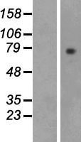 Lactoperoxidase (LPO) Human Over-expression Lysate