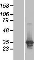 LASP1 Human Over-expression Lysate