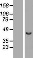Septin 2 (SEPT2) Human Over-expression Lysate