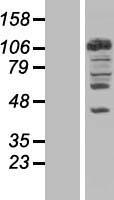 NEDD4 Human Over-expression Lysate