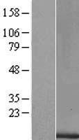 OCM2 Human Over-expression Lysate
