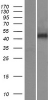 Kallistatin (SERPINA4) Human Over-expression Lysate
