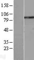 PLCD1 Human Over-expression Lysate