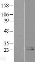 Nociceptin (PNOC) Human Over-expression Lysate