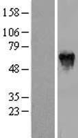 PFKFB2 Human Over-expression Lysate