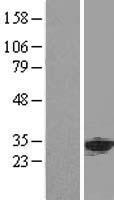 PHAP1 (ANP32A) Human Over-expression Lysate