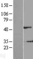 SEM1 Human Over-expression Lysate