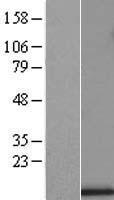 UQCRB Human Over-expression Lysate