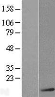 S100 beta (S100B) Human Over-expression Lysate