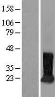 CDIPT Human Over-expression Lysate