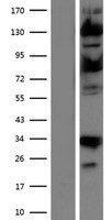 USP15 Human Over-expression Lysate