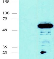 CFDP1 Human Over-expression Lysate