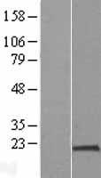 PPIH Human Over-expression Lysate