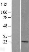 ATP5PD Human Over-expression Lysate