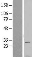 VTI1B Human Over-expression Lysate
