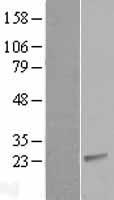CIB2 Human Over-expression Lysate