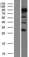 DDX17 Human Over-expression Lysate