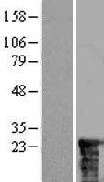 ZNRD2 Human Over-expression Lysate