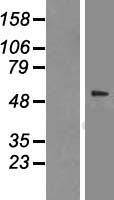 TCP1 beta (CCT2) Human Over-expression Lysate