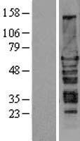 HEXIM1 Human Over-expression Lysate