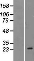 MAD4 (MXD4) Human Over-expression Lysate