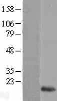 REG1 beta (REG1B) Human Over-expression Lysate