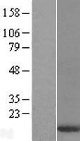 DYNLT3 Human Over-expression Lysate