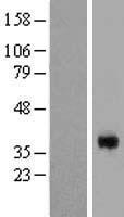 CGR19 (CGRRF1) Human Over-expression Lysate