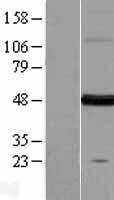 FARS2 Human Over-expression Lysate