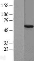 TCP1 theta (CCT8) Human Over-expression Lysate