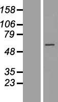 CCT6B Human Over-expression Lysate