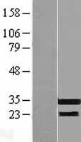 RFPL3 Human Over-expression Lysate