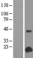 CPLX1 Human Over-expression Lysate