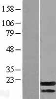 C7orf16 (PPP1R17) Human Over-expression Lysate