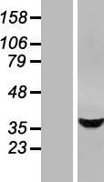 PCTP L (STARD10) Human Over-expression Lysate