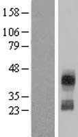 CD300C Human Over-expression Lysate