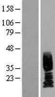 Uroplakin II (UPK2) Human Over-expression Lysate