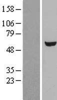 UGP2 Human Over-expression Lysate