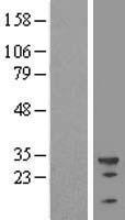 U2AF35 (U2AF1) Human Over-expression Lysate