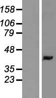 LMAN2 Human Over-expression Lysate
