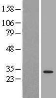 14-3-3 theta (YWHAQ) Human Over-expression Lysate