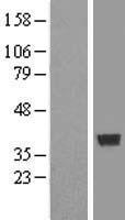 COPS6 Human Over-expression Lysate
