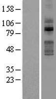 TLK2 Human Over-expression Lysate