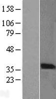 PIM2 Human Over-expression Lysate