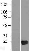 CRYGD Human Over-expression Lysate